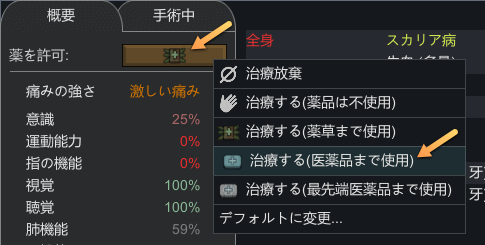 RimWorld スカリア病の治療、使用する薬を医薬品に設定